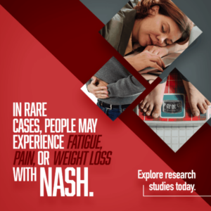 Nash symptoms, clinical research