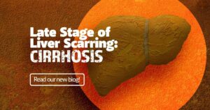 Late stage of liver scarring: Cirrhosis, liver disease research