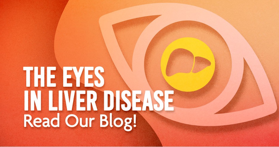 The eyes in liver disease. Read our blog!