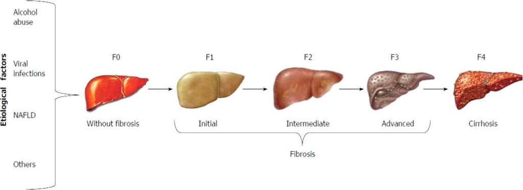 liver disorders graphic e1659490118985 - Arizona's Leading Liver Clinic