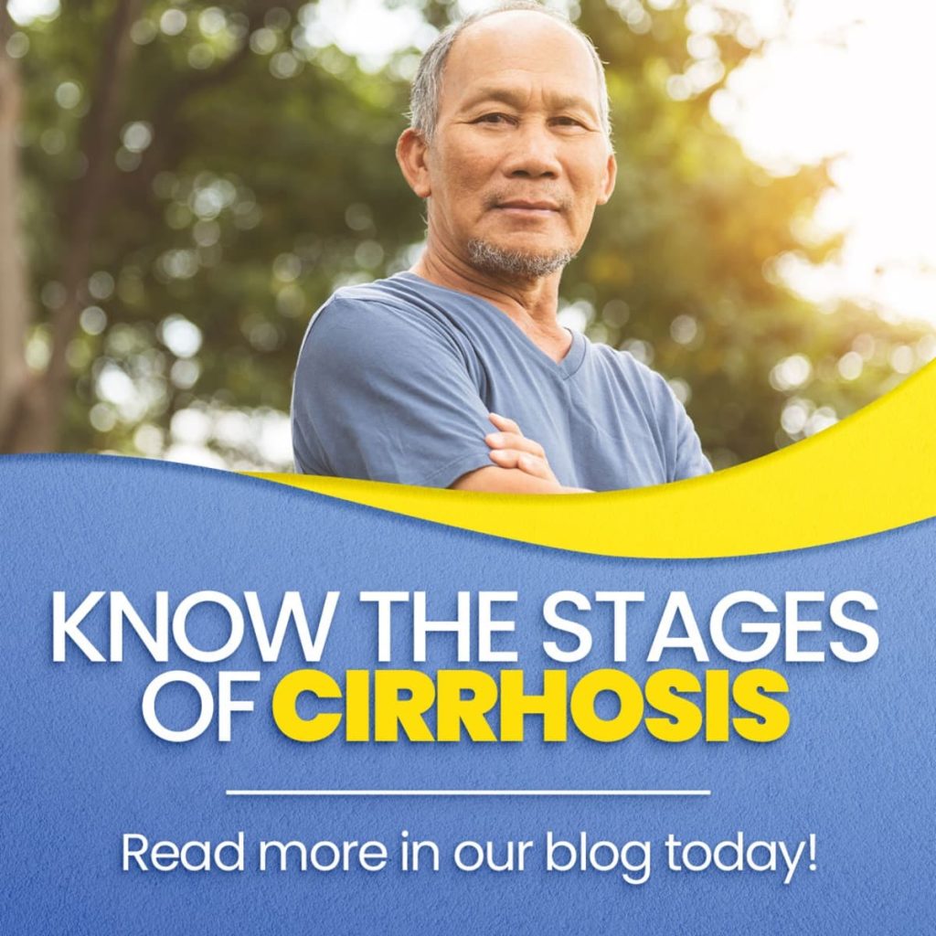 Know the stages of cirrhosis